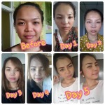 Rangsit Aesthetic Plastic Surgery Clinic