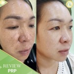 Chic Clinic Co., Ltd.