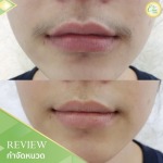 Chic Clinic Co., Ltd.