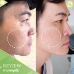 Chic Clinic Co., Ltd.