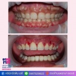 คลินิกทำฟัน สมุทรปราการ