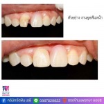 คลินิกทำฟัน สมุทรปราการ