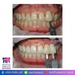 คลินิกทำฟัน สมุทรปราการ