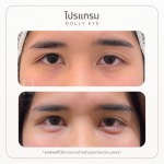 คลินิกความสวยความงามรัชดา 17