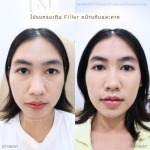 คลินิกความสวยความงามรัชดา 17