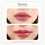ฟิลเลอร์ปาก รัชดา - คลินิกความสวยความงามรัชดา 17