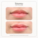 คลินิกความสวยความงามรัชดา 17